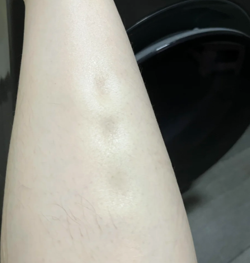 消水腫穴道全解析：中醫推薦8大黃金穴位，輕鬆告別水腫體質