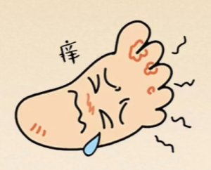 突然開始流腳汗