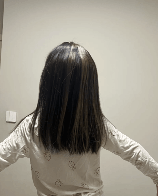 頭皮紅紅的