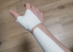 手臂突然酸痛