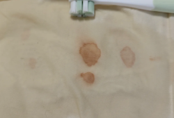 乾掉的血漬如何清洗