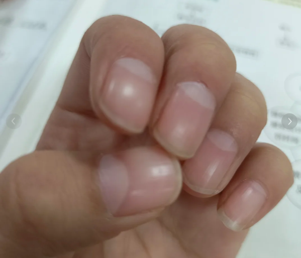 指甲月牙