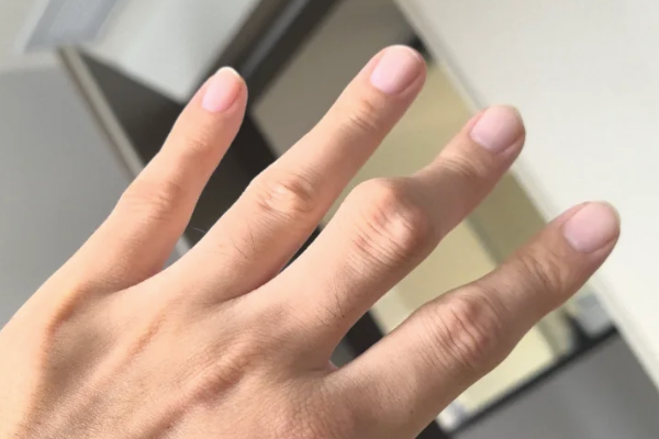 【痛風不能吃的食物表】痛風不能吃的水果、蔬菜、肉類有哪些？